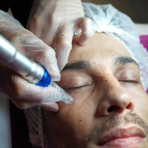 Hydrafacial 1